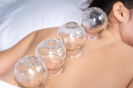 cupping thérapie